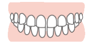 すきっ歯（空隙歯列）