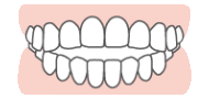 前歯が閉じない（開咬）